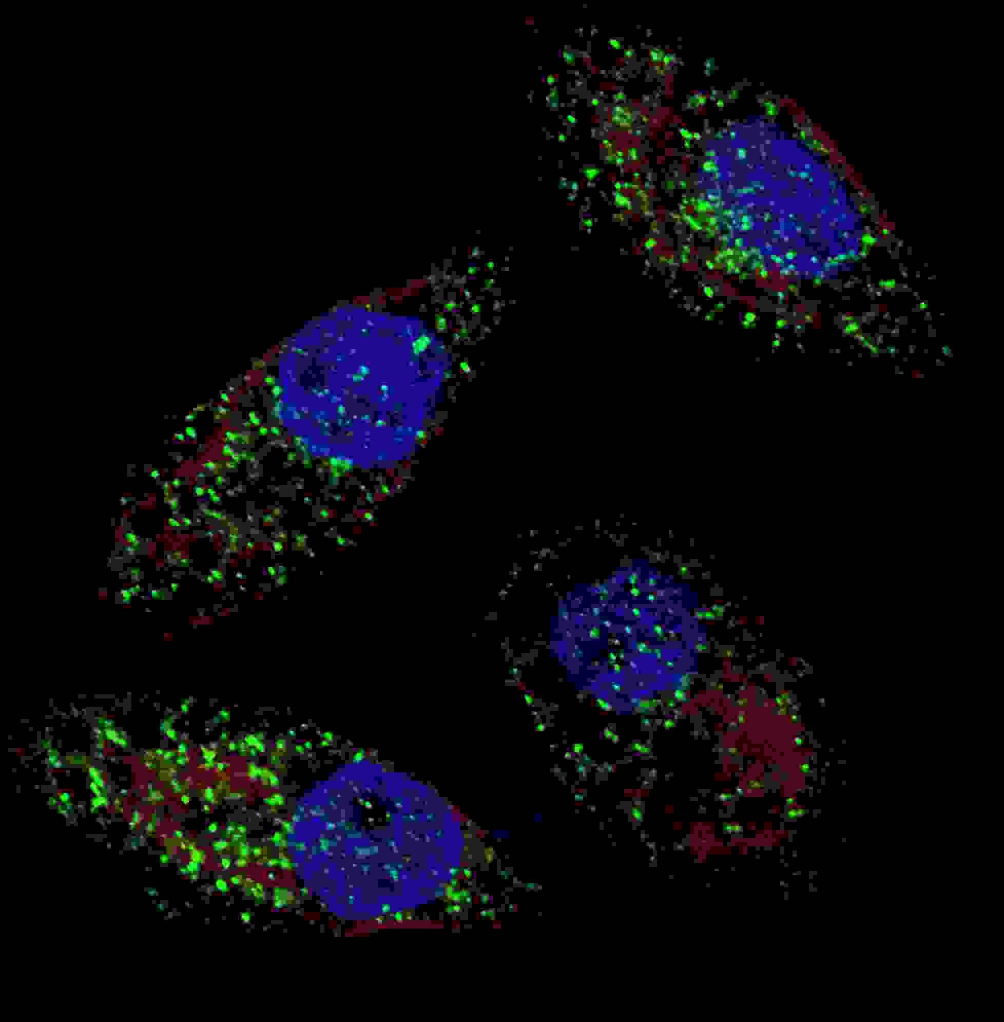 MAP1LC3B / LC3B Antibody (aa89-122)