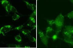 MAP1LC3B / LC3B Antibody (aa89-122)