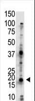 Polyclonal Rabbit anti-Human UBE2G2 Antibody (aa17-47, WB)