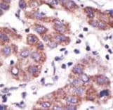 Polyclonal Rabbit anti-Human USP3 / UBP Antibody (aa114-143, IHC, WB)