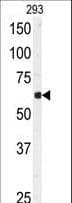 Polyclonal Rabbit anti-Human USP3 / UBP Antibody (aa114-143, IHC, WB)