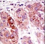 USP7 / HAUSP Antibody (aa1060-1090)