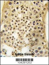 USP7 / HAUSP Antibody (aa1060-1090)