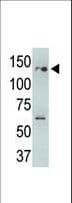 Polyclonal Rabbit anti-Human USP25 Antibody (aa133-163, WB)