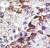 Polyclonal Rabbit anti-Human UBE2E3 Antibody (aa10-40, IHC, WB)