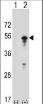 Polyclonal Rabbit anti-Human STAM1 / STAM Antibody (aa1-30, WB)