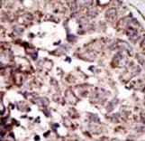 Polyclonal Rabbit anti-Human AGER / RAGE Antibody (aa29-59, IHC, WB)