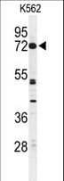 CNGA2 Antibody (aa75-102)