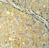 Polyclonal Rabbit anti-Human SDHAF1 Antibody (aa34-62, IHC, WB)