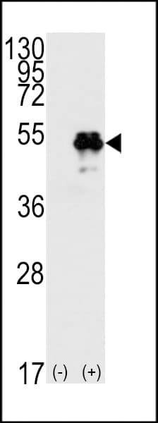 Polyclonal Rabbit anti-Human TP53 / p53 Antibody (Thr55, IHC, IF, WB)