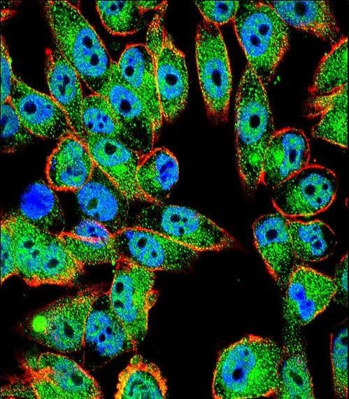 Polyclonal Rabbit anti-Human TP53 / p53 Antibody (Thr55, IHC, IF, WB)