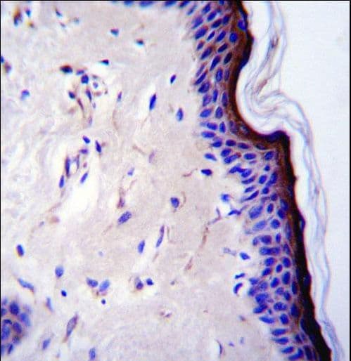 Polyclonal Rabbit anti-Human TP53 / p53 Antibody (Thr55, IHC, IF, WB)