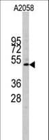 Polyclonal Rabbit anti-Human CCNE1 / Cyclin E1 Antibody (aa373-402, IHC, WB)