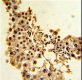Polyclonal Rabbit anti-Human CCNE1 / Cyclin E1 Antibody (aa373-402, IHC, WB)