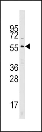 CDC25A Antibody (N-Terminus)