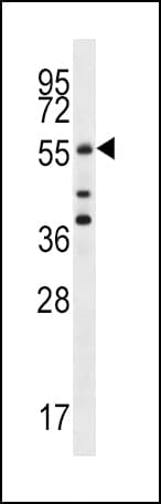 Polyclonal Rabbit anti-Human CDC25A Antibody (Ser78, WB)