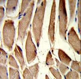 Polyclonal Rabbit anti-Human RRM2 Antibody (aa96-125, IHC, WB)
