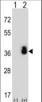 Polyclonal Rabbit anti-Human SRSF1 / SF2 Antibody (aa11-38, IHC, WB)