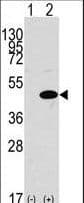 Polyclonal Rabbit anti-Human MAPK3 / ERK1 Antibody (aa1-30, IHC, WB)
