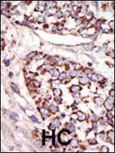 Polyclonal Rabbit anti-Human MAPK3 / ERK1 Antibody (aa1-30, IHC, WB)