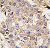 Polyclonal Rabbit anti-Human MAPK3 / ERK1 Antibody (aa1-30, IHC, WB)