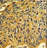 CDK2 Antibody (aa230-260)