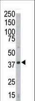 Polyclonal Rabbit anti-Human CDK4 Antibody (aa273-305, IHC, IF, WB)
