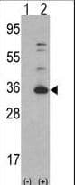 Polyclonal Rabbit anti-Human CDK4 Antibody (aa273-305, IHC, IF, WB)