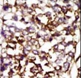 Polyclonal Rabbit anti-Human CDK4 Antibody (aa273-305, IHC, IF, WB)