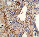 Polyclonal Rabbit anti-Human CDK4 Antibody (aa273-305, IHC, IF, WB)
