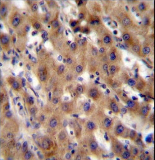 Polyclonal Rabbit anti-Human SRPK1 Antibody (aa1-30, IHC, WB)