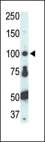 Polyclonal Rabbit anti-Human FER Antibody (aa782-811, IHC, IF, WB)