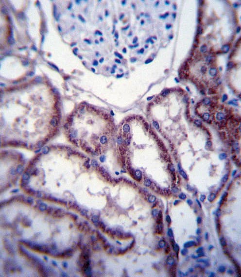 Polyclonal Rabbit anti-Human FER Antibody (aa782-811, IHC, IF, WB)