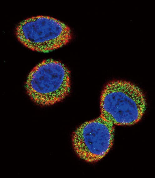 Polyclonal Rabbit anti-Human FER Antibody (aa782-811, IHC, IF, WB)