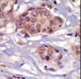 SYN / FYN Antibody (aa13-43)