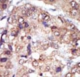 LYN Antibody (aa32-62)