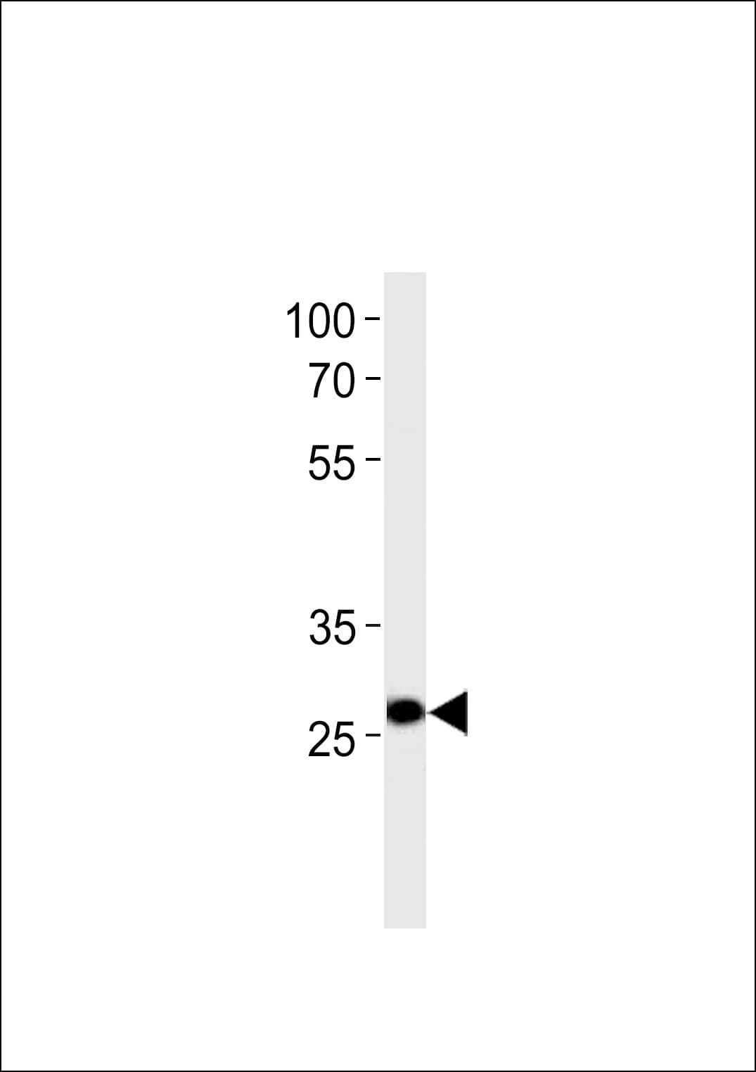 Polyclonal Rabbit anti-Human PDX1 Antibody (aa186-215, IF, WB)