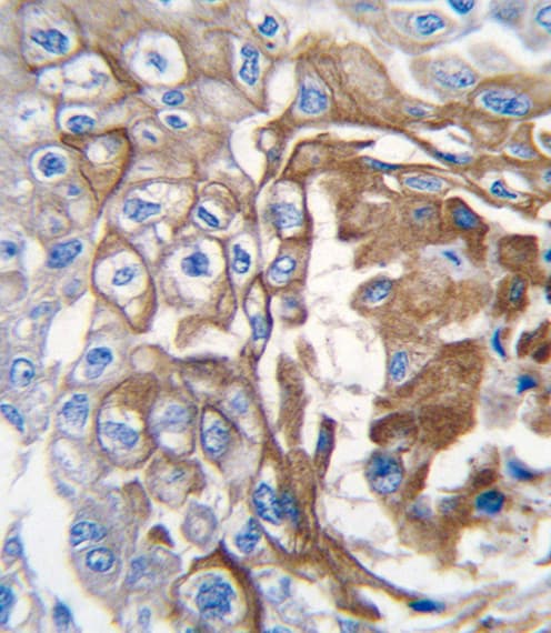 Polyclonal Rabbit anti-Human NRAS / N-ras Antibody (aa147-179, IHC, WB)