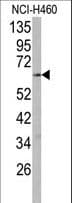 Cytochrome P450 2R1 / CYP2R1 Antibody (aa464-496)