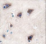 Cytochrome P450 2R1 / CYP2R1 Antibody (aa464-496)