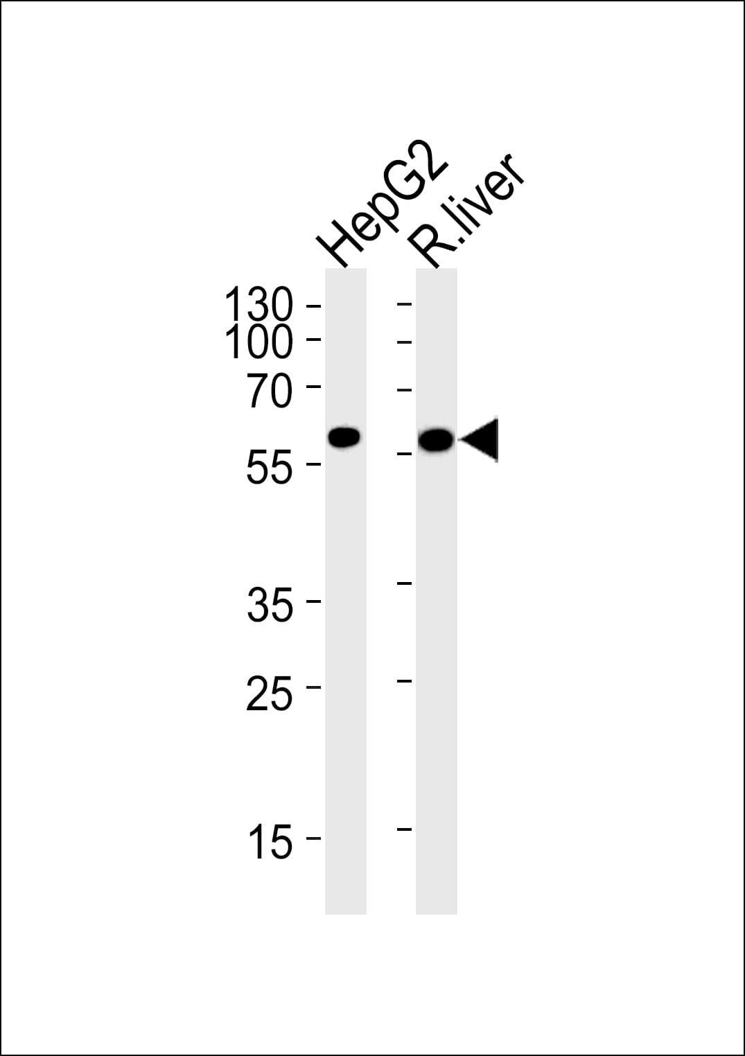 Polyclonal Rabbit anti-Human GCK / Glucokinase Antibody (aa1-30, IHC, IF, WB)