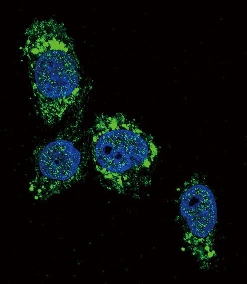 Polyclonal Rabbit anti-Human GCK / Glucokinase Antibody (aa1-30, IHC, IF, WB)