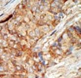 Polyclonal Rabbit anti-Human GCK / Glucokinase Antibody (aa1-30, IHC, IF, WB)