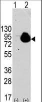 Polyclonal Rabbit anti-Human RPS6KA1 / RSK1 Antibody (Ser732, IHC, WB)