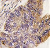 Polyclonal Rabbit anti-Human RPS6KA1 / RSK1 Antibody (Ser732, IHC, WB)