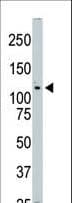 Polyclonal Rabbit anti-Human STK10 / LOK Antibody (aa692-721, IHC, WB)