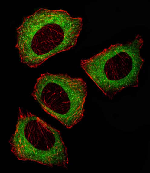 Polyclonal Rabbit anti-Human MAP2K2 / MKK2 / MEK2 Antibody (aa262-292, IHC, IF, WB)