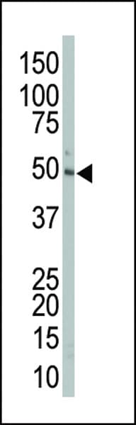 Polyclonal Rabbit anti-Human MAP2K2 / MKK2 / MEK2 Antibody (aa262-292, IHC, IF, WB)