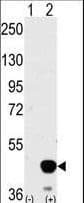 Polyclonal Rabbit anti-Human MAP2K2 / MKK2 / MEK2 Antibody (aa262-292, IHC, IF, WB)