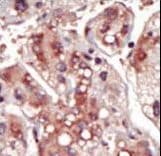 Polyclonal Rabbit anti-Human MAP2K2 / MKK2 / MEK2 Antibody (aa262-292, IHC, IF, WB)